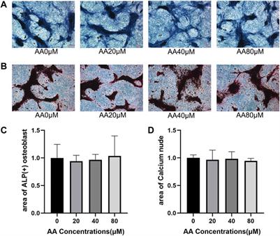 Asiatic Acid Attenuates Osteoporotic Bone Loss in Ovariectomized Mice Through Inhibiting NF-kappaB/MAPK/ Protein Kinase B Signaling Pathway